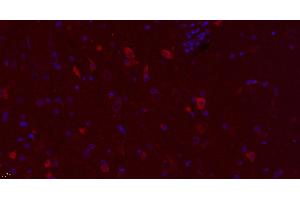 Paraformaldehyde-fixed, paraffin embedded rat brain, Antigen retrieval by boiling in sodium citrate buffer (pH6. (DRD3 anticorps  (AA 352-446) (Alexa Fluor 594))
