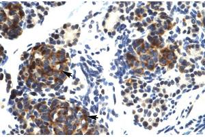 Human Pancreas; TRIM41 antibody - C-terminal region in Human Pancreas cells using Immunohistochemistry (TRIM41 anticorps  (C-Term))