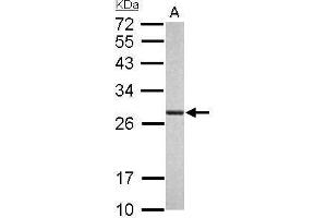 WB Image Proteasome 20S alpha 6 antibody detects PSMA6 protein by Western blot analysis.