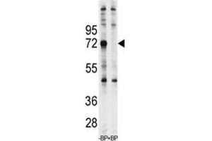 Western blot analysis of Ubiquilin-1 antibody pre-incubated with and without blocking peptide in Jurkat lysate (Ubiquilin 1 anticorps  (AA 40-70))