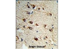 Formalin-fixed and paraffin-embedded human brain tissue reacted with FMOD Antibody (C-term), which was peroxidase-conjugated to the secondary antibody, followed by DAB staining.