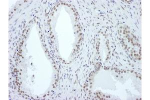 anti-Achaete-Scute Complex Homolog 2 (ASCL2) (C-Term) antibody