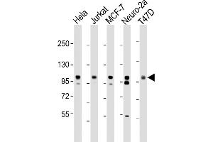All lanes : Anti-EZH2 Antibody at 1:2000 dilution Lane 1: Hela whole cell lysate Lane 2: Jurkat whole cell lysate Lane 3: MCF-7 whole cell lysate Lane 4: Neuro-2a whole cell lysate Lane 5: T47D whole cell lysate Lysates/proteins at 20 μg per lane.