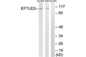 Western blot analysis of extracts from 293/HuvEc cells, using EFTUD2 Antibody.