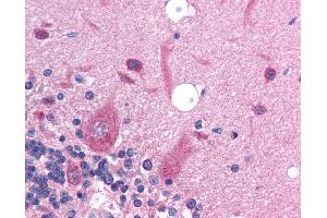 Anti-SLC17A2 antibody IHC of human brain-cerebellum.