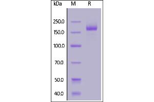 SARS-CoV-2 S protein trimer, His Tag on  under reducing (R) condition.