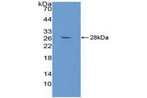 Western blot analysis of recombinant Human aZGP1. (AZGP1 anticorps)