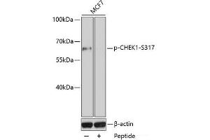 Western blot analysis of extracts of MCF7 cell line using Phospho-CHEK1(S317) Polyclonal Antibody. (CHEK1 anticorps  (pSer317))