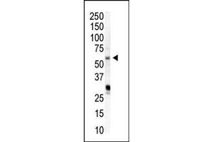 Western blot analysis of anti-PIP5K1A Pab (ABIN392593 and ABIN2842123) in HeLa cell lysate.