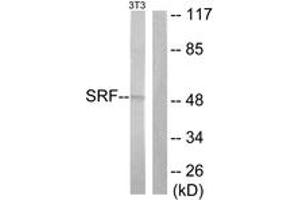 Western blot analysis of extracts from NIH-3T3 cells, treated with PMA 125ng/ml 30', using SRF (Ab-99) Antibody. (SRF anticorps  (AA 71-120))