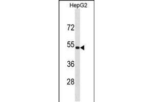 Western blot analysis in HepG2 cell line lysates (35ug/lane). (ZNF773 anticorps  (N-Term))