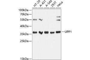 Western blot analysis of extracts of various cell lines, using UPP1 Antibody (ABIN6128903, ABIN6149952, ABIN6149953 and ABIN6216895) at 1:3000 dilution. (UPP1 anticorps  (AA 89-173))