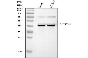 Western blot analysis of MEK4/MAP2K4 using anti-MEK4/MAP2K4 antibody (ABIN3042559).