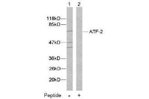 Image no. 2 for anti-Activating Transcription Factor 2 (ATF2) (Ser112), (Ser94) antibody (ABIN197152) (ATF2 anticorps  (Ser94, Ser112))