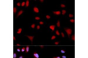 Immunofluorescence analysis of MCF-7 cells using Phospho-ABL1(Y204) Polyclonal Antibody (ABL1 anticorps  (pTyr204))