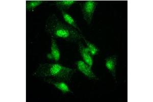 Immunofluorescence (IF) image for anti-K(lysine) Acetyltransferase 2A (KAT2A) (AA 411-837) antibody (ABIN487349) (KAT2A anticorps  (AA 411-837))