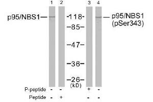 Image no. 2 for anti-Nibrin (NBN) (Ser343) antibody (ABIN197201) (Nibrin anticorps  (Ser343))