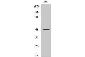 Western Blotting (WB) image for anti-Inhibitor of kappa Light Polypeptide Gene Enhancer in B-Cells, Kinase gamma (IKBKG) (Tyr363) antibody (ABIN3185154)