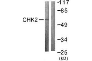 Western blot analysis of extracts from COS7 cells treated with UV 30', using Chk2 (Ab-383) Antibody. (CHEK2 anticorps  (AA 356-405))