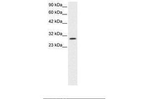 Image no. 3 for anti-Jumonji Domain Containing 8 (JMJD8) (AA 111-160) antibody (ABIN6735793) (JMJD8 anticorps  (AA 111-160))