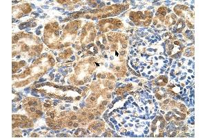 GCNT3 antibody was used for immunohistochemistry at a concentration of 4-8 ug/ml to stain EpitheliaI cells of renal tubule (arrows) in Human Kidney.