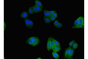 Immunofluorescent analysis of HepG2 cells using ABIN7170364 at dilution of 1:100 and Alexa Fluor 488-congugated AffiniPure Goat Anti-Rabbit IgG(H+L)