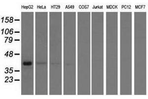 Image no. 3 for anti-3-hydroxyisobutyryl-CoA Hydrolase (HIBCH) antibody (ABIN1498655)