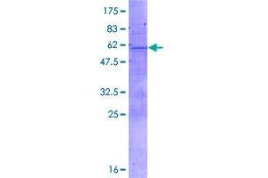 Image no. 1 for T-Cell Leukemia Homeobox 2 (TLX2) (AA 1-284) protein (GST tag) (ABIN1322891)