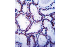 SLC22A1 Antibody immunohistochemistry analysis in formalin fixed and paraffin embedded human kidney tissue followed by peroxidase conjugation of the secondary antibody and DAB staining.