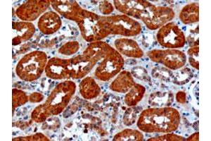 USH1C polyclonal antibody  (10 ug/mL) staining of paraffin embedded human kidney. (USH1C anticorps)