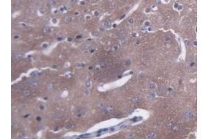 Detection of AMPH in Mouse Cerebrum Tissue using Polyclonal Antibody to Amphiphysin (AMPH) (Amphiphysin anticorps  (AA 24-240))