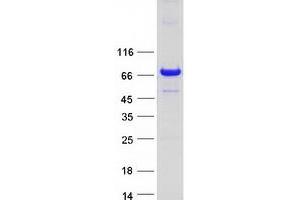 Validation with Western Blot
