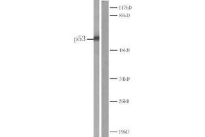 Western blot analysis of extracts from COS7 cells Left: Using P53 (Ab-20) antibody (E022030). (p53 anticorps)