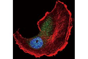 Confocal immunofluorescent analysis of Phospho-TSC2- Antibody (ABIN389863 and ABIN2839723) with MCF-7 cell followed by Alexa Fluor 488-conjugated goat anti-rabbit lgG (green).