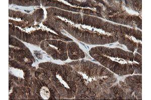 Image no. 3 for anti-Phosphoinositide-3-Kinase, Catalytic, gamma Polypeptide (PIK3CG) antibody (ABIN1500207)