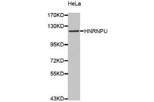 Western Blotting (WB) image for anti-Heterogeneous Nuclear Ribonucleoprotein U (Scaffold Attachment Factor A) (HNRNPU) (AA 608-825) antibody (ABIN6220424) (HNRNPU anticorps  (AA 608-825))