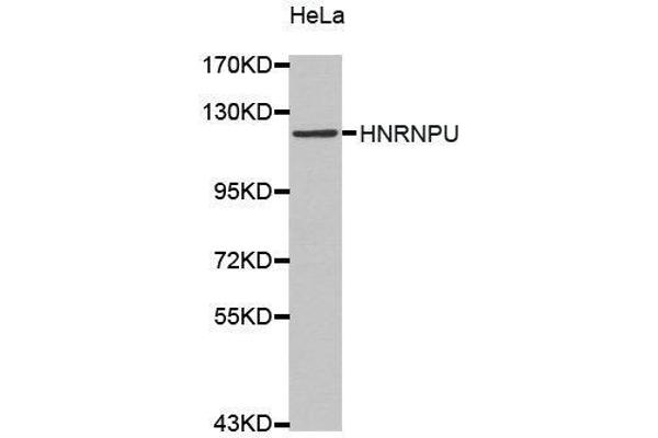 HNRNPU 抗体  (AA 608-825)