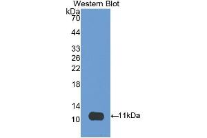 Western Blotting (WB) image for anti-CD3d Molecule, delta (CD3-TCR Complex) (CD3D) (AA 19-99) antibody (ABIN3205927) (CD3D anticorps  (AA 19-99))