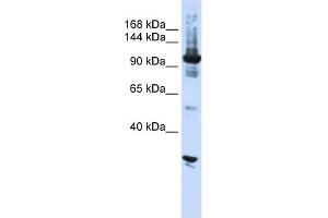 WB Suggested Anti-DIS3 Antibody Titration:  0. (DIS3 anticorps  (N-Term))