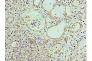 Immunohistochemistry of paraffin-embedded human kidney tissue using ABIN7157845 at dilution of 1:100 (EPM2A anticorps  (AA 244-331))