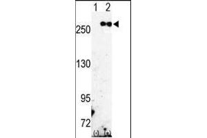 Western blot analysis of FASN (arrow) using rabbit polyclonal FASN Antibody (Center) (ABIN391654 and ABIN2841563).