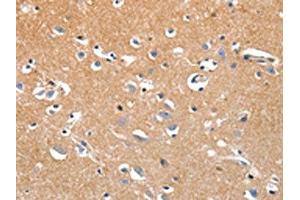 The image on the left is immunohistochemistry of paraffin-embedded Human brain tissue using ABIN7191320(LRP3 Antibody) at dilution 1/80, on the right is treated with synthetic peptide. (LRP3 anticorps)