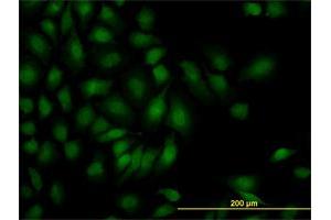 Immunofluorescence of monoclonal antibody to SMAD1 on HeLa cell.