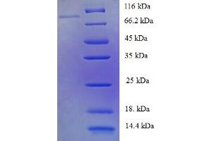 SDS-PAGE (SDS) image for Protein-tyrosine Phosphatase 1C (PTPN6) (AA 1-597), (Isoform 2) protein (His-SUMO Tag) (ABIN5710185)