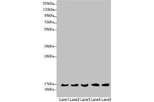 Western blot All lanes: MRPS16 antibody at 1. (MRPS16 anticorps  (AA 1-137))