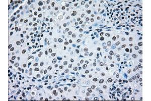 Image no. 11 for anti-B-Raf proto-oncogene, serine/threonine kinase (BRAF) antibody (ABIN1496961)