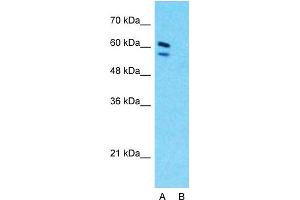 Host:  Rabbit  Target Name:  CBS  Sample Type:  HepG2  Lane A:  Primary Antibody  Lane B:  Primary Antibody + Blocking Peptide  Primary Antibody Concentration:  1ug/ml  Peptide Concentration:  5ug/ml  Lysate Quantity:  25ug/lane/lane  Gel Concentration:  0.