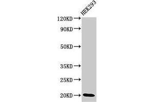 Western Blot Positive WB detected in: HEK293 whole cell lysate All lanes: DLX6 antibody at 3.