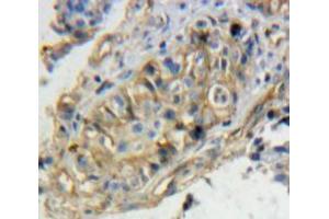 Used in DAB staining on fromalin fixed paraffin-embedded Ovary tissue (TPBG anticorps  (AA 34-356))