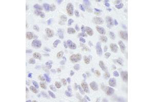 Immunohistochemistry (IHC) image for anti-Scaffold Attachment Factor B (SAFB) (C-Term) antibody (ABIN7448784) (SAFB anticorps  (C-Term))